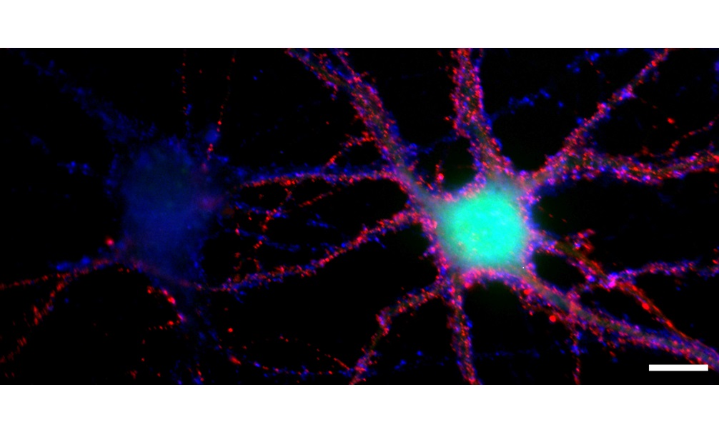 Representative image of an immunofluorescently labled cultured hippocampal neurons. The red label shows the homologously expressed α2δ-2 proteins and the blue label shows presynaptic terminals (synapsin). Scale bar: 10 µm. (Copyright Sabrin Haddad and Gerald Obermair)