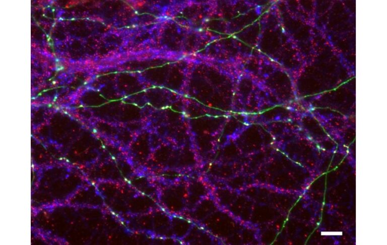 Bildunterschrift: Beispielbild von fluoreszenzgefärbten kultivierten Hippocampus-Neuronen. Synaptische Proteine sind blau (präsynaptischer vesikulärer Glutamattransporter Typ 1) und rot (postsynaptische GABA-A-Rezeptoren) gefärbt. Axone sind grün markiert (GFP, grün fluoreszierendes Protein) und zeigen, wo sich Synapsen entlang postsynaptischer Strukturen von Nevernzellen bilden. Maßstabsleiste: 10 µm. (Copyright Sabrin Haddad und Gerald Obermair)