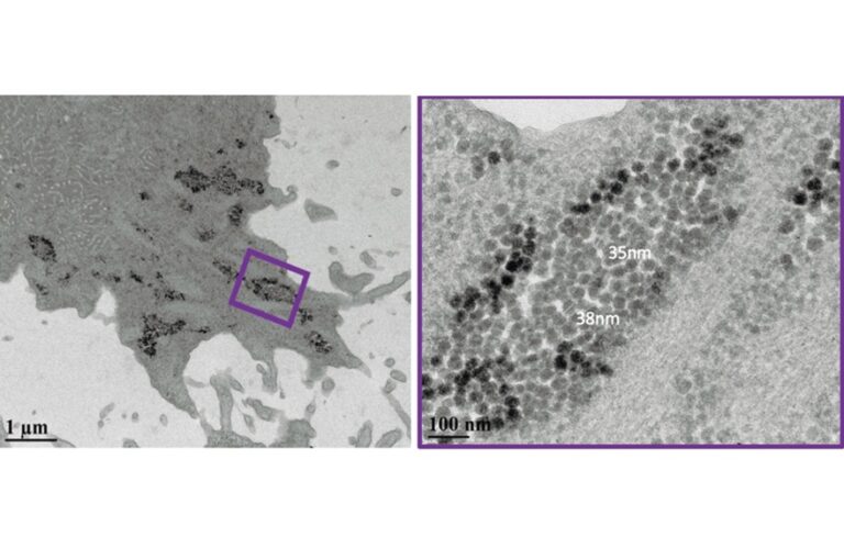 Versteckte Viren: Amöben als „Trojanische Pferde“ im Wasser-Sicherheits-Management? Studie der Karl Landsteiner Privatuniversität zeigt, dass Darmviren in Wasseramöben überdauern können – und fordert eine Neubeurteilung der Regeln zur Wassersicherheit. Krems (Österreich), 18. Dezember 2025 – Wichtige Auslöser viraler Magen-Darm-Erkrankungen können über längere Zeit in freilebenden Amöben überdauern, die in natürlichen und technischen Wassersystemen weit verbreitet sind. Dies ist das Ergebnis einer Studie der Karl Landsteiner Privatuniversität (KL Krems) gemeinsam mit internationalen Partnern. Die Analyse ergab, dass sich Noro- und Adenoviren in verschiedenen Entwicklungsstadien der Amöben „verstecken“ können – und danach auch weiterhin infektiös bleiben. Diese Resultate legen nahe, dass freilebende Amöben bisher unterschätzte Reservoirs und Transportvehikel für Magen-Darm-Viren sein können. Das könnte erklären, warum bestimmte Viren in manchen Wassersystemen länger nachweisbar sind als erwartet – und eine verfeinerte Risikobewertungen und Ableitung von Managementmaßnahmen bei der Nutzung von Wasserressourcen rechtfertigen. Global verursachen Krankheitserreger in verunreinigtem Wasser und in Lebensmitteln nach wie vor erhebliche gesundheitliche Belastungen, obwohl Trinkwasseraufbereitung und Abwasserbehandlung deutlich verbessert wurden. Das Humane Norovirus ist die häufigste Ursache akuter viraler Gastroenteritis, wobei bereits wenige Viruspartikel ausreichen, um Infektionen auszulösen. Humane Adenoviren werden ebenfalls regelmäßig in Abwässern und in abwasserbelasteten Flüssen und Seen nachgewiesen. Klassische Konzepte der Wassersicherheit betrachten Viren vor allem als frei im Wasser schwebende oder an Partikel gebundene Einheiten. Tatsächlich konnte aber in letzter Zeit gezeigt werden, dass auch freilebende Amöben – Einzeller, die in Wassersystemen vorkommen und bisher nur als Reservoir für Bakterien und andere Mikroorganismen bekannt waren – pathogene Viren beherbergen können. Vor diesem Hintergrund untersuchte ein Team des Fachbereichs Wasserqualität und Gesundheit der KL Krems gemeinsam mit Kolleginnen und Kollegen aus Kanada, Asien und Australien, wie Noro- und Adenoviren in verschiedenen Amöbenarten überdauern und welchen Einfluss das auf das Infektionsrisiko durch Wasser haben könnte. VERSTECK IM EINZELLER “In der Wasser-Mikrobiologie kennen wir Amöben seit Langem als Wirte für Bakterien wie Legionellen. Doch ihre Rolle für menschliche Magen-Darm-Viren ist bisher erstaunlich wenig beachtet worden“, sagt Dr. Mats Leifels, Wissenschaftler am Fachbereich Wasserqualität und Gesundheit der KL Krems und Erstautor der Studie. „Unsere Experimente zeigen, dass häufig vorkommende Amöben diese Viren nicht einfach verdauen und somit inaktivieren. Sie können sie schützen, transportieren und im Fall des Adenovirus möglicherweise sogar frühe Schritte viraler Reproduktion unterstützen.“ Dieses Zusammenwirken von Einzellern wie Amöben und Magen-Darm-Viren verändere den Blick darauf, wie Wasser als Übertragungsweg funktioniert und wie sicher etablierte Aufbereitungsverfahren Viren tatsächlich inaktivieren können, so Leifels. Um diese Fragen zu untersuchen, kultivierte das Team die humanen Noro- und Adenoviren gemeinsam mit drei freilebenden Amöbenarten: Vermamoeba vermiformis, Acanthamoeba polyphaga und Willaertia magna. Alle drei Arten kommen in realen Wassersystemen häufig vor. Mithilfe quantitativer PCR (macht das Erbmaterial der Viren messbar) und Fluoreszenzmikroskopie (zeigt, wo die Viren in den Zellen sitzen) verfolgten die Forschenden das Schicksal der Viren über zwölf Tage. Norovirus-Genome fanden sich im Zytoplasma und in Vakuolen von V. vermiformis und A. polyphaga. Adenoviren wurden hingegen im Zellkern von W. magna beobachtet. Intakte Virionen – also vollständige, infektiöse Viruspartikel – blieben während des gesamten Versuchs in verschiedenen Lebensstadien der Amöben und in von ihnen abgeschnürten Vesikeln nachweisbar. Es zeigte sich auch, dass nach der Übertragung von Adenovirus-haltigen Amöben auf Zellkulturen infektiöse Viren nachzuweisen sind – die “Passage” über die Amöben machte die Viren also nicht unschädlich. Zusätzlich wies das Team Adenovirus-mRNA (einen sehr kurzlebigen genetischen Botenstoff) für die Bildung viraler Faserproteinen nach – ein Hinweis auf eine mögliche Virusvermehrung im Amöbenwirt. MÖGLICHE FOLGEN FÜR DEN WASSERSCHUTZ Freilebende Amöben sind ausgesprochen widerstandsfähig. In ihrer Ruheform, der Zyste, überstehen sie hohe Dosen gängiger chemischer Desinfektionsmittel wie Chlor. Unter solchen Bedingungen werden viele andere Mikroorganismen hingegen inaktiviert. Wenn pathogene Viren von Amöben aufgenommen und mittransportiert werden, können sie daher möglicherweise einzelnen Barrieren in Aufbereitungs- und Sanitärsystemen entgehen. Die neue Studie legt nahe, dass solche Amöben-assoziierten Viren nicht nur für die Trinkwassergewinnung relevant sind, sondern auch für abwasserbelastete Badegewässer und für Systeme der Wasserwiederverwendung. „Aus Sicht der mikrobiologischen Risikobewertung müssen wir freilebende Amöben als mögliche Reservoirs und Transportvehikel – quasi „virale Trojanische Pferde“ – zukünftig mitbedenken, wenn wir Aussagen über die Persistenz und ihre Effizienz der Entfernung von Wasser-übertragbaren, fäkalbürtigen Viren tätigen“, erklärt Univ.-Prof. Dr. Andreas Farnleitner, Leiter des Fachbereich Wasserqualität und Gesundheit an der KL Krems und des ICC Water & Health* sowie Ko-Autor der Studie. „Nur dann bilden unsere Konzepte zur Wassersicherheit die tatsächliche Komplexität realer Wassersysteme ab.“ Mit Klimawandel, Urbanisierung und zunehmender Wasserknappheit wächst der Druck auf Oberflächen- und Grundwasserressourcen. Damit steigt auch der Bedarf, verborgene mikrobielle Wechselwirkungen besser zu verstehen. Die Autorinnen und Autoren betonen, dass die vorliegenden Ergebnisse auf Labormodellen beruhen. Weitere Studien sollen beispielsweise klären, welche Virusmengen in Amöben in realen Gewässern tatsächlich vorkommen. Schon jetzt sehen sie jedoch gute Gründe, freilebende Amöben in zukünftigen Studien zur Wassersicherheit und Wasserwiederverwendung zu berücksichtigen. Außerdem braucht es Monitoring Ansätze, die zwischen wirklich inaktivierten und infektiösen Viren unterscheiden, die im Inneren von Protozoen vorkommen. Die Studie fügt sich nahtlos in den strategischen Fokus der KL Krems ein: In ihrer Forschung konzentriert sich die Universität auf interdisziplinäre Themenfelder mit hoher gesundheitspolitischer Relevanz – darunter der Forschungsschwerpunkt Exposom & Umweltgesundheit mit den Themengebieten Ernährungswissenschaften, Allergologie sowie Wasserqualität und Gesundheit. Mit den neuen Daten zur „Viren–Amöben-Interaktion“ wollen KL Krems und ihre Partnerinstitutionen Regulierungsbehörden dabei unterstützen, nachhaltige und wissenschaftlich fundierte („global-change-resistente“) Maßnahmen zum Schutz der öffentlichen Gesundheit weiterzuentwickeln. Links und vollständige Kontaktdetails hier: https://prd.at/newsroom-kunden/versteckte-viren-amoeben-als-trojanische-pferde-im-wasser-sicherheits-management/ Originalpublikation: Enteric Viruses and Free-Living Amoebae: Protozoa as Potential Reservoirs and Transport Vessels for Human Norovirus and Adenovirus, M Leifels: R Dey: A R Wiedemeyer: D Cheng: C Kolm: F Wu: K Sirikanchana: A H Farnleitner: N J Ashbolt, Water & Ecology 2025, 1(3): 100018, doi:10.1016/j.wateco.2025.100018. Karl Landsteiner Privatuniversität (Stand 12/2025) Die Karl Landsteiner Privatuniversität (KL Krems) ist eine international anerkannte Bildungs- und Forschungseinrichtung am Campus Krems. Die KL Krems bietet eine moderne, bedarfsorientierte Aus- und Weiterbildung in der Medizin und Psychologie sowie ein PhD-Programm im Bereich Mental Health and Neuroscience an. Das flexible Bildungsangebot ist auf die Bedürfnisse der Studierenden, die Anforderungen des Arbeitsmarkts sowie auf die Herausforderungen der Wissenschaft abgestimmt. Die drei Universitätskliniken in Krems, St. Pölten und Tulln sowie das Ionentherapie- und Forschungszentrum MedAustron in Wiener Neustadt gewährleisten eine klinische Lehre und Forschung auf höchstem Qualitätsniveau. In der Forschung konzentriert sich die KL Krems auf interdisziplinäre Felder mit hoher gesundheitspolitischer Relevanz – u.a. der mentalen Gesundheit, der molekularen Onkologie und den Neurowissenschaften sowie dem Thema Wasserqualität und den damit verbundenen gesundheitlichen Aspekten. Die KL Krems wurde 2013 gegründet und von der Österreichischen Agentur für Qualitätssicherung und Akkreditierung (AQ Austria) akkreditiert. *Das ICC Water & Health (Deutsch: Interuniversitäre Kooperationszentrum Wasser und Gesundheit) ist eine Kooperation der Technischen Universität Wien, der Medizinischen Universität Wien und der Karl Landsteiner Privatuniversität für Gesundheitswissenschaften. Das ICC W&H versteht sich als international sichtbar agierende wissenschaftliche Plattform und kompetenter Partner in Fragen der Wasserqualität und deren Auswirkung auf die menschliche Gesundheit. Das ICC W&H widmet sich der Entwicklung innovativer Konzepte zur Beurteilung der Wasserqualität, neuer mikrobiologischer und molekularbiologischer Methoden, der Wirksamkeitsprüfung physikalischer und chemischer Aufbereitungsmethoden sowie numerischer Modelle zur Abschätzung des Infektions- und Krankheitsrisikos bei der Wassernutzung. Die gewonnenen Erkenntnisse werden zur Ableitung effektiver und nachhaltiger Managementmaßnahmen zum Schutz der Gesundheit verwendet. Das ICC wurde dank kompetitiver Forschungsförderungsmittel durch das Bundesministerium für Wissenschaft, Forschung und Wirtschaft (BMWFW) nachhaltig etabliert. Im Jahr 2017 wurde das ICC Water & Health um die Karl Landsteiner Privatuniversität für Gesundheitswissenschaften (KL) erweitert. Bildunterschrift: TEM of A. polyphaga co-cultured with HNoV © Dr. Rafik Dey