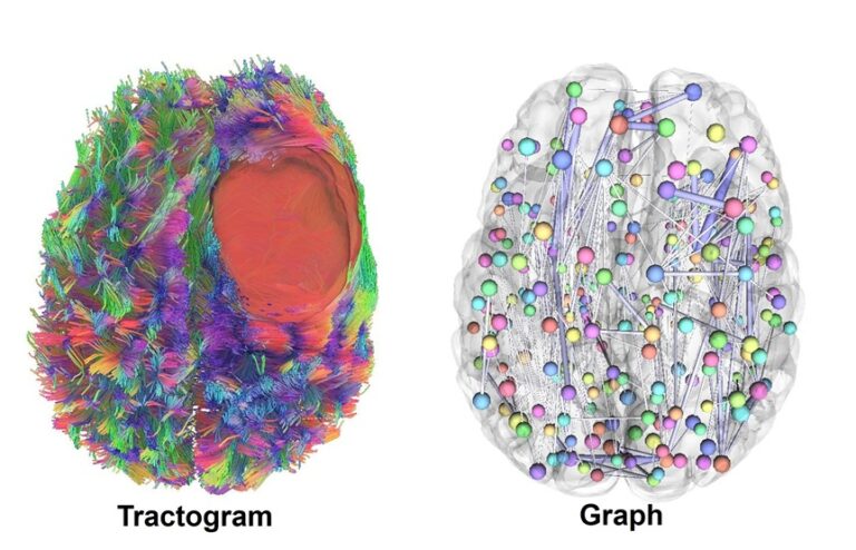 Bildbeschreibung: "MRT-basierte Rekonstruktion von Verbindungen im Gehirn (links) und ihre vereinfachte Darstellung als Netzwerk (rechts)” © Prof. Stadlbauer