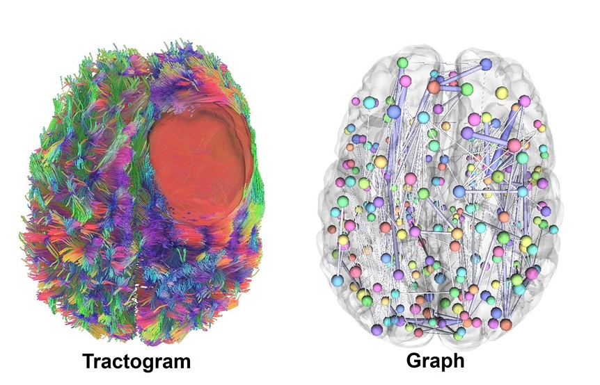 Bildbeschreibung: "MRT-basierte Rekonstruktion von Verbindungen im Gehirn (links) und ihre vereinfachte Darstellung als Netzwerk (rechts)” © Prof. Stadlbauer